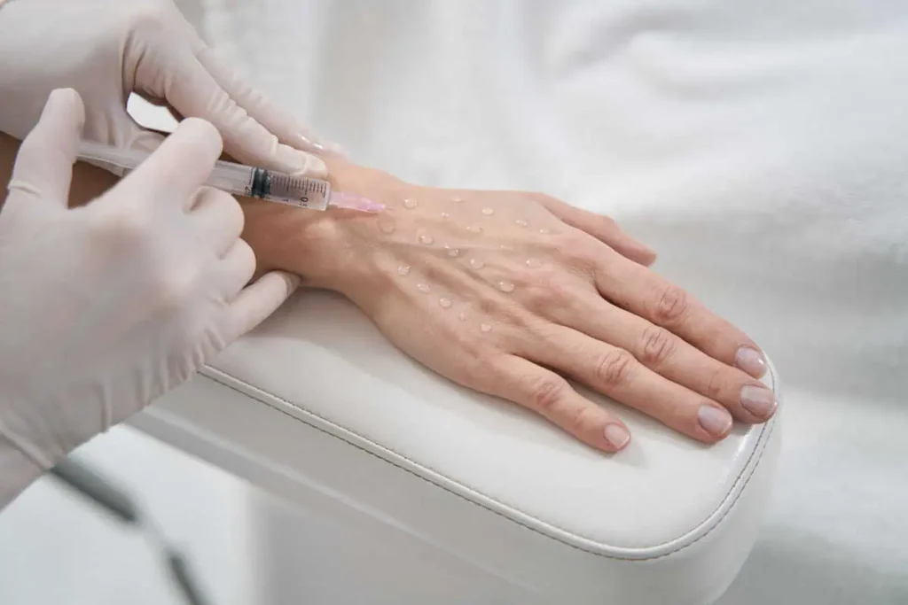 hand Rejuvenation in Hoboken, NJ and Weehawken, NJ | 1aesthetics
