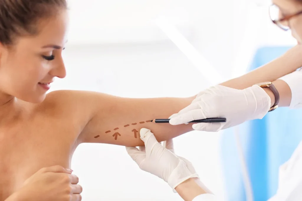 Arm lift in Hoboken, NJ and Weehawken, NJ | 1aesthetics