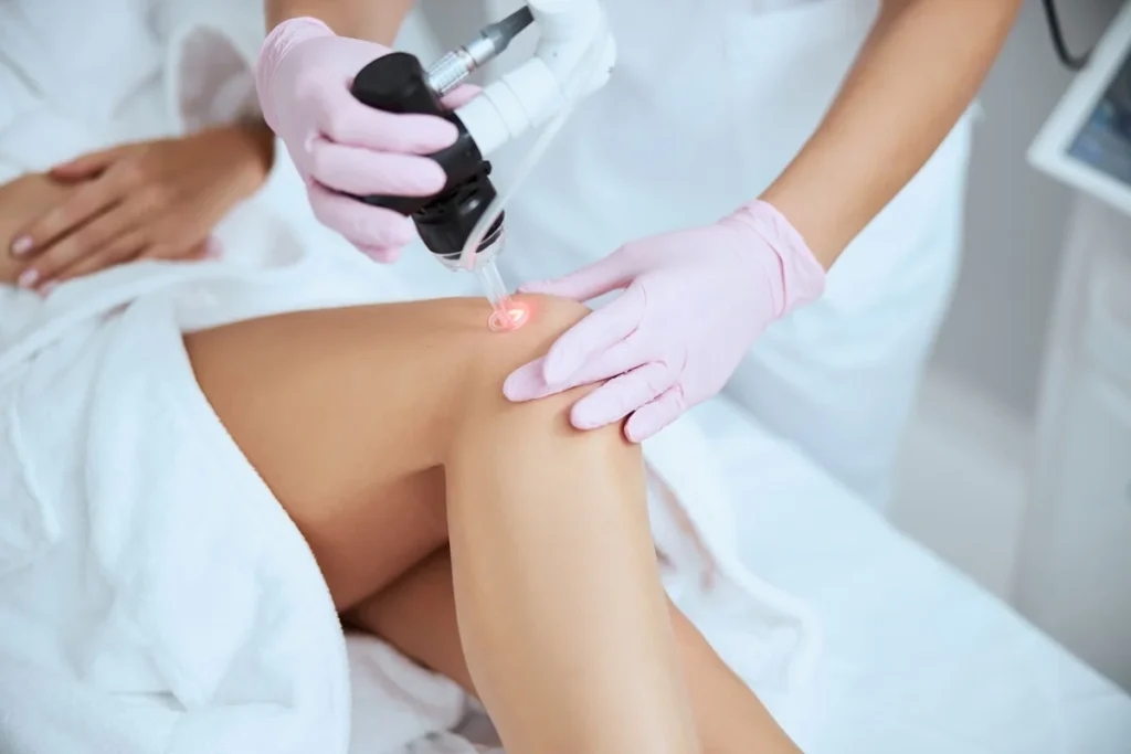 Laser Spider Vein Treatment in Hoboken, NJ and Weehawken, NJ | 1aesthetics