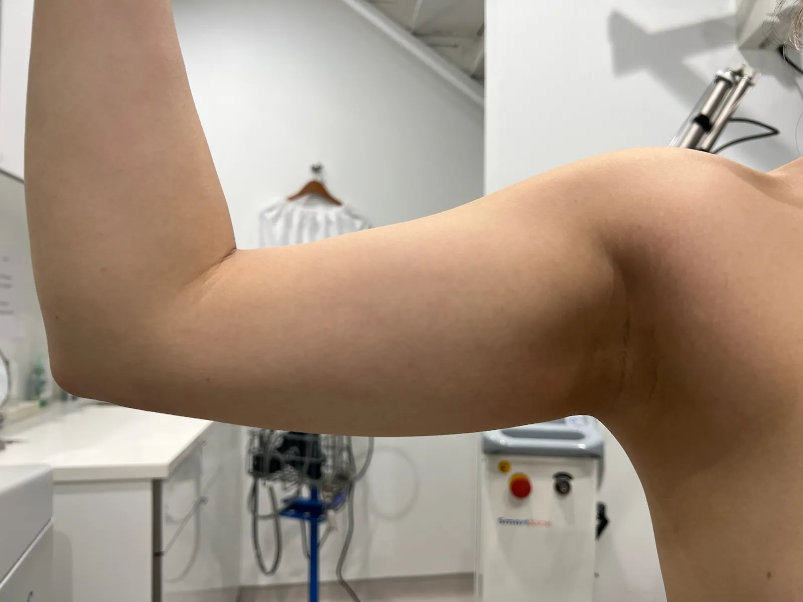 a person's arm in a room | 1aesthetics in Hoboken, NJ and Weehawken, NJ