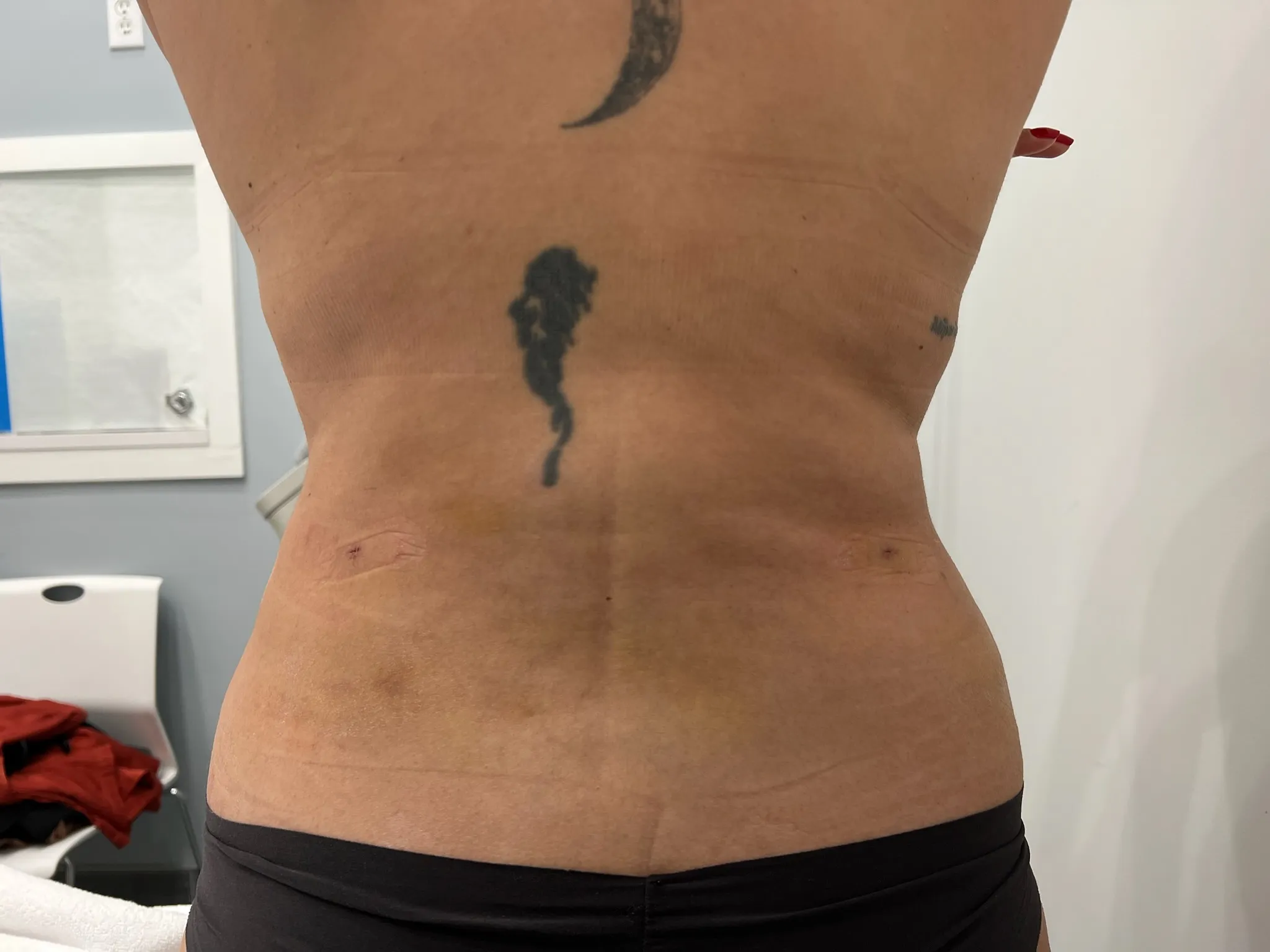 a person's back with tattoos | 1aesthetics in Hoboken, NJ and Weehawken, NJ