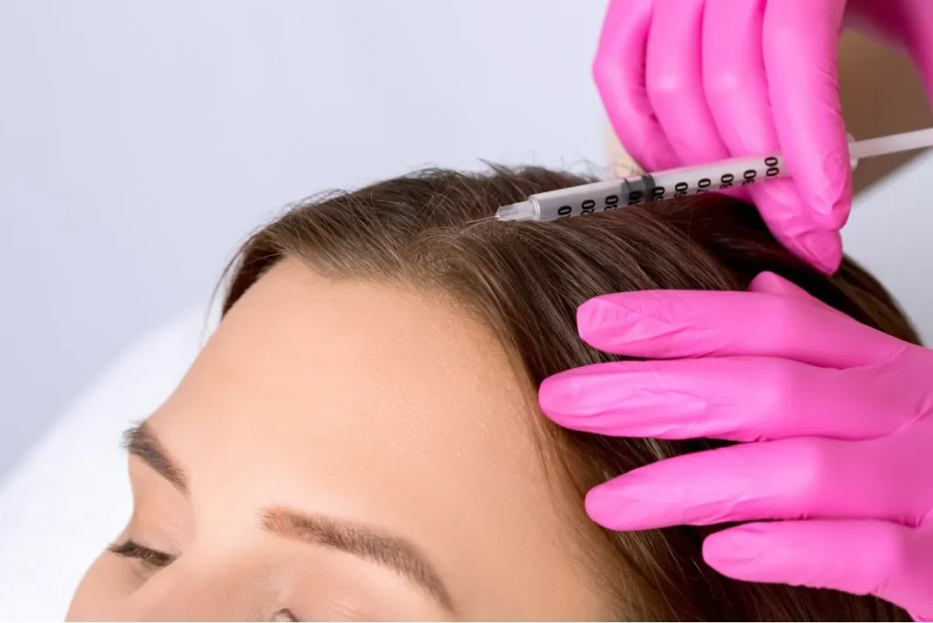Natural Growth Factor Injections hair restoration | Hoboken and Weehawken NJ | 1Aesthetic