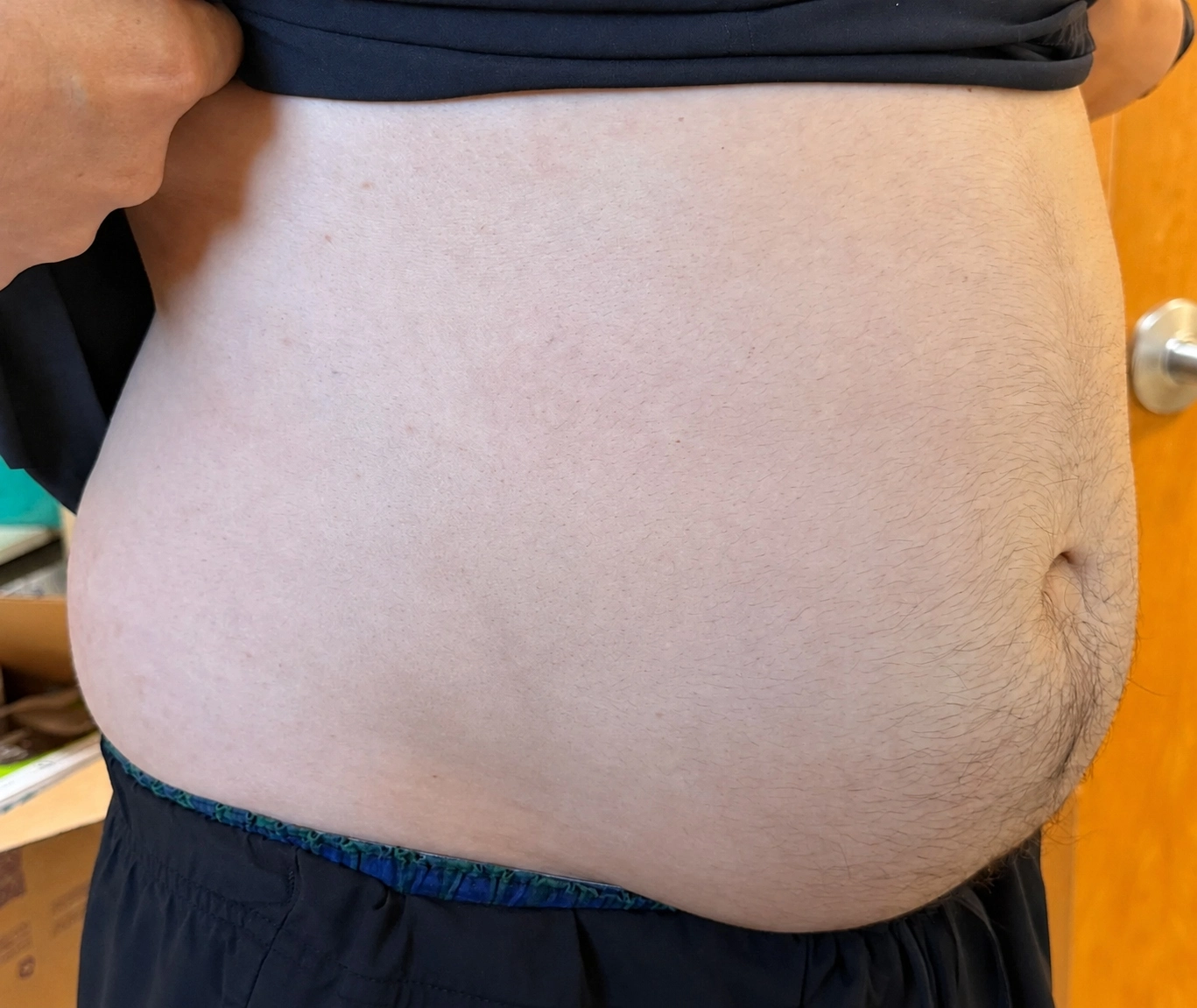 Tirzepatide before and after