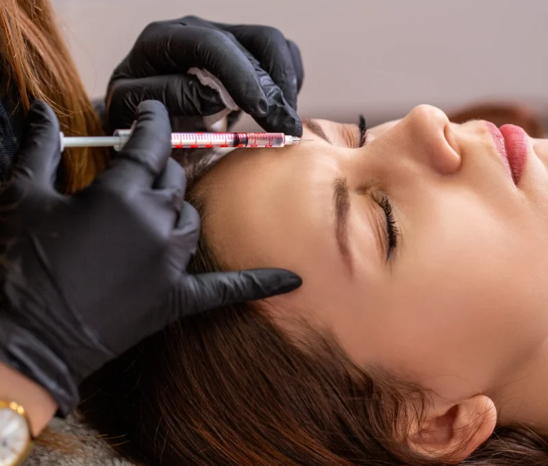 Forehead Filler