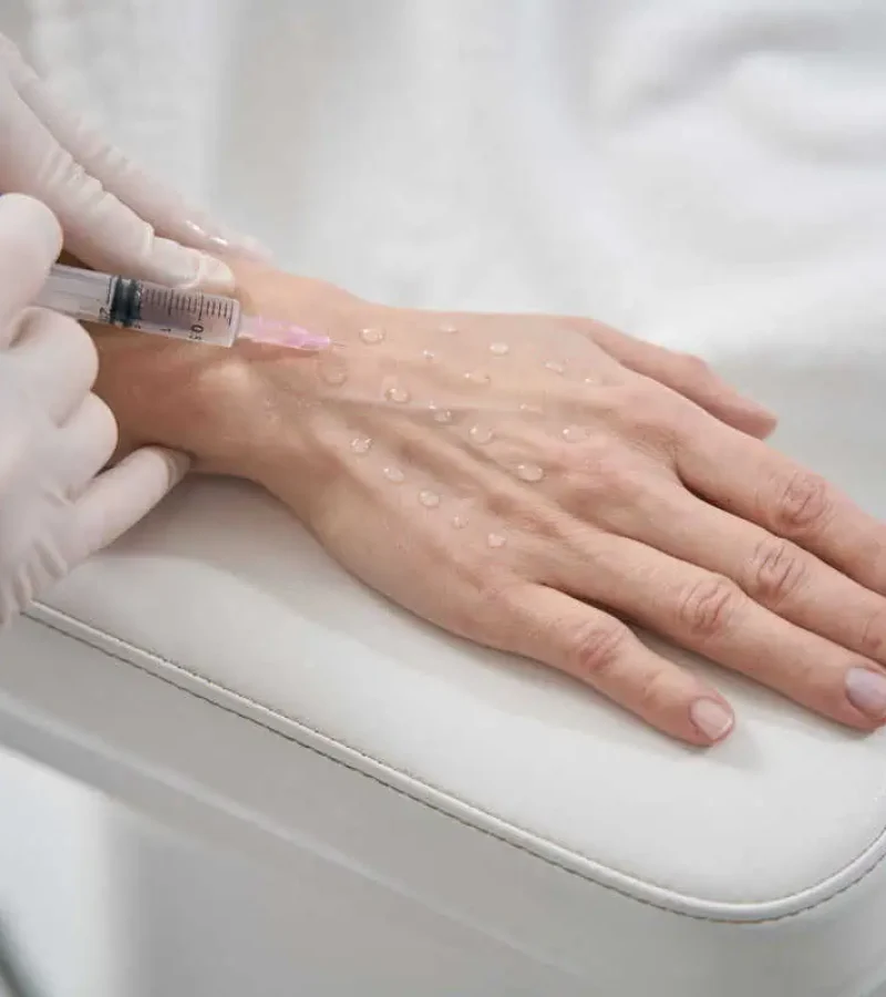 hand Rejuvenation in Hoboken, NJ and Weehawken, NJ | 1aesthetics