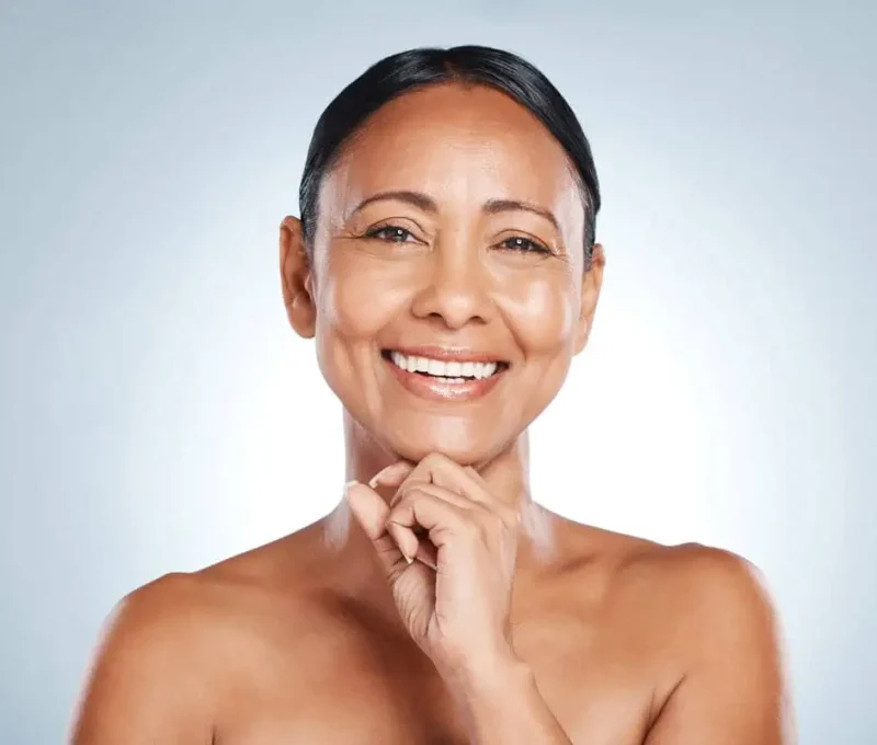 Laser Pigment Melasma Removal in Hoboken, NJ and Weehawken, NJ | 1aesthetics