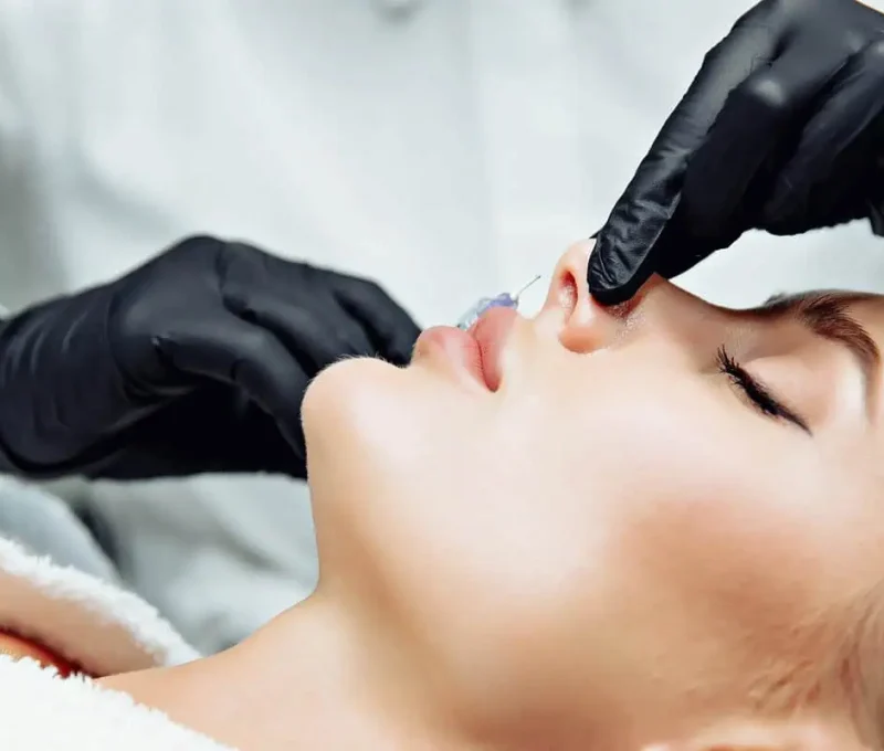 Liquid nose job in Hoboken, NJ and Weehawken, NJ | 1aesthetics