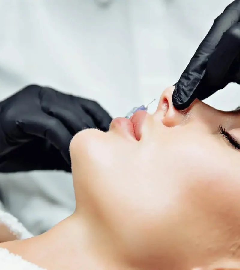 Liquid nose job in Hoboken, NJ and Weehawken, NJ | 1aesthetics