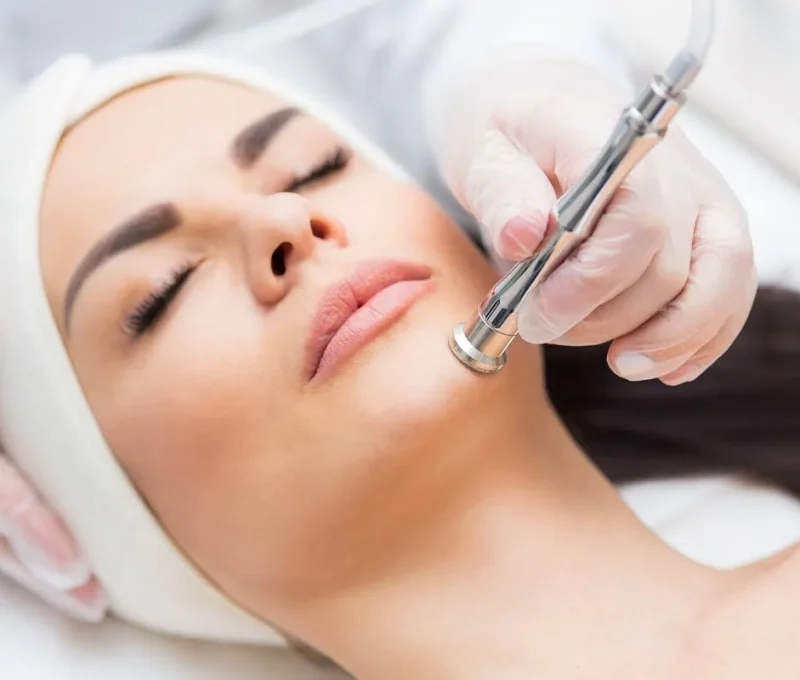 Microdermabrasion in Hoboken, NJ and Weehawken, NJ | 1aesthetics