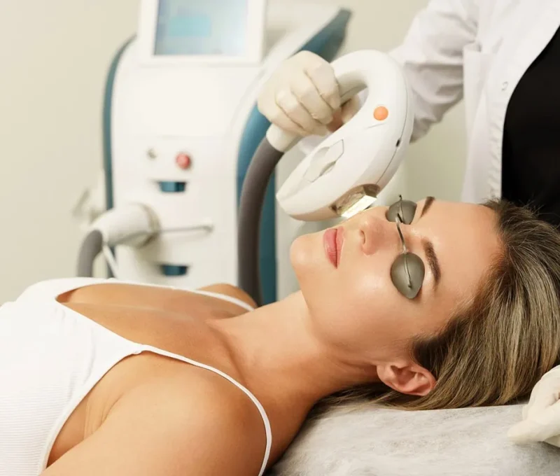 IPL Photofacial in Hoboken, NJ and Weehawken, NJ | 1aesthetics