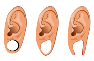 ear lobes